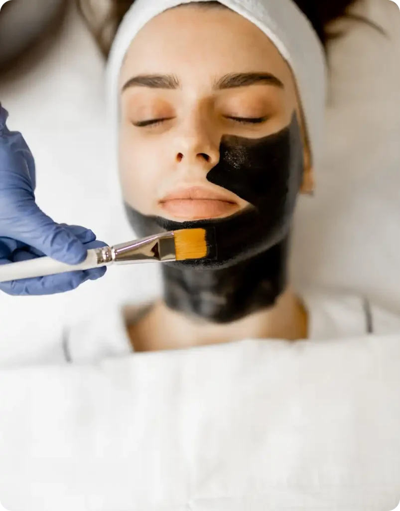 Carbon Facial