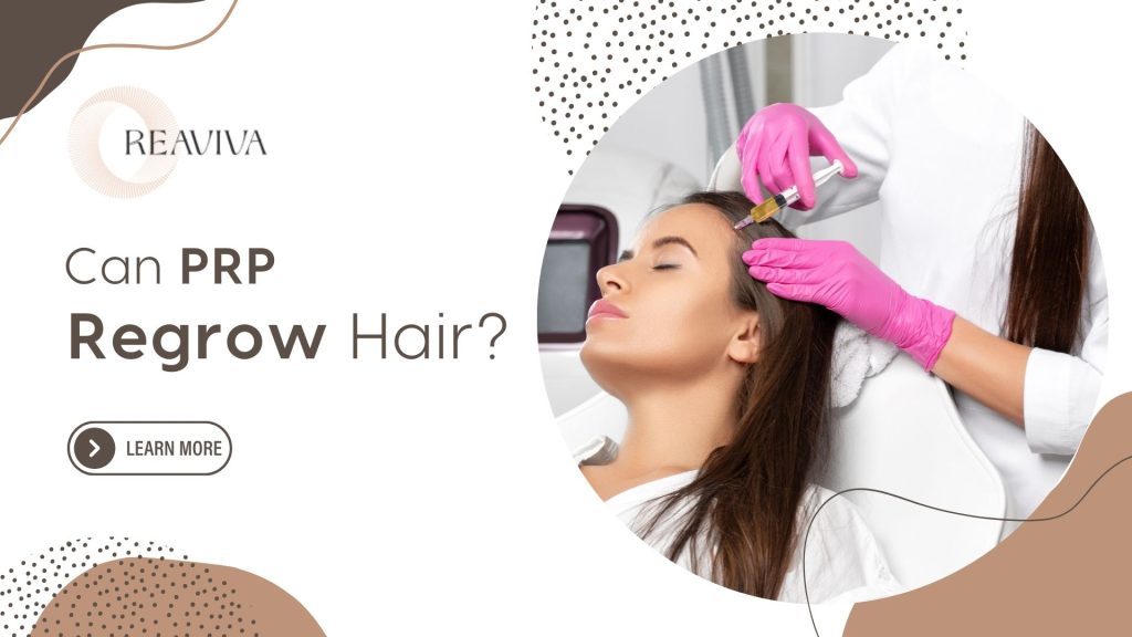 PRP hair treatment being performed on a woman with a syringe injection to promote hair regrowth, highlighting PRP therapy benefits.