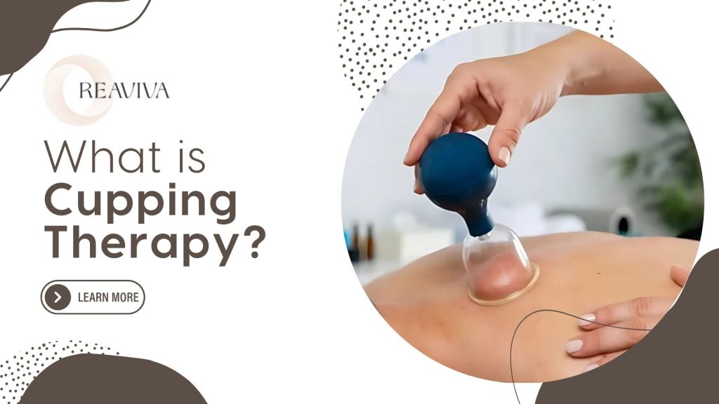 Close-up of a therapist performing cupping therapy on a person's back with a suction cup, featuring text 'What is Cupping Therapy?' and a 'Learn More' button.