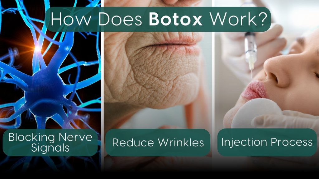 An infographic explaining how Botox works, featuring three sections: blocking nerve signals represented by a neuron image, reducing wrinkles illustrated by an older person's facial wrinkles, and the injection process depicted by a syringe administering Botox to a woman's face.