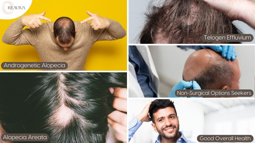 Collage of hair loss conditions showing androgenetic alopecia, alopecia areata, telogen effluvium, and non-surgical treatment options, with a smiling man representing good overall health as ideal candidates for PRP therapy.