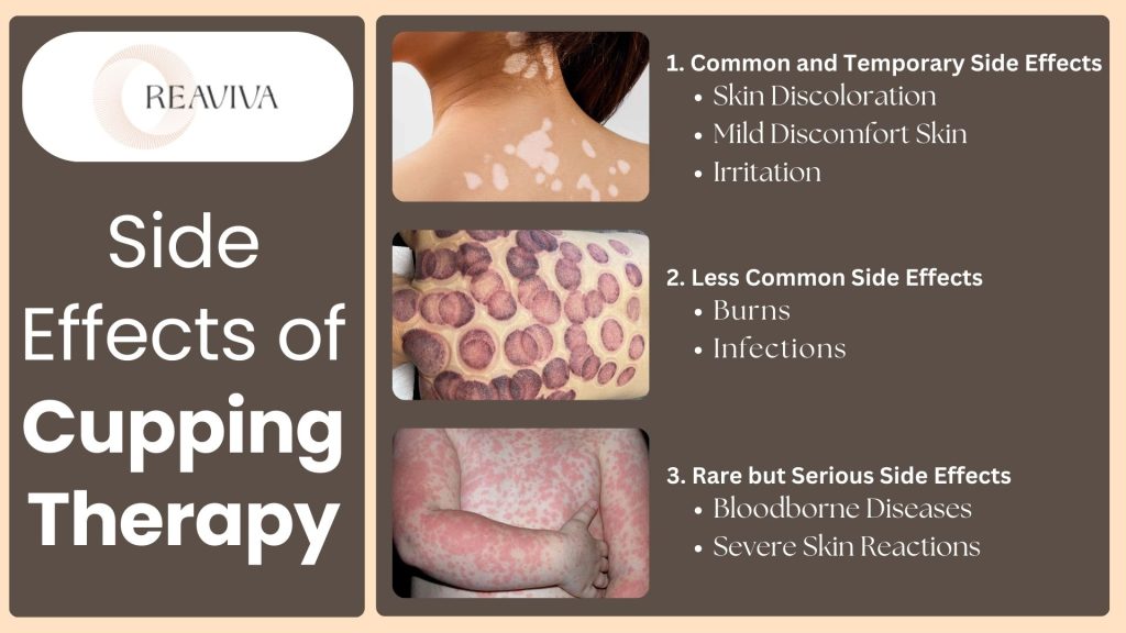 Side effects of cupping therapy showing skin discoloration, burns, infections, and severe skin reactions with visual examples of common, less common, and rare side effects.