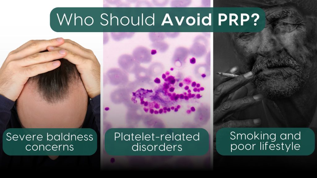 Individuals who should avoid PRP therapy, including those with severe baldness, platelet-related disorders, or unhealthy habits like smoking and poor lifestyle choices, visually represented in a three-part collage.