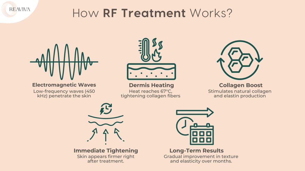 Illustration explaining how RF (Radio Frequency) treatment works. The process involves electromagnetic waves (450 kHz) penetrating the skin, heating the dermis up to 67°C to tighten collagen fibers. This stimulates natural collagen and elastin production, leading to immediate skin tightening and long-term improvements in texture and elasticity. RF treatment is a popular non-invasive skincare solution for anti-aging and skin rejuvenation.