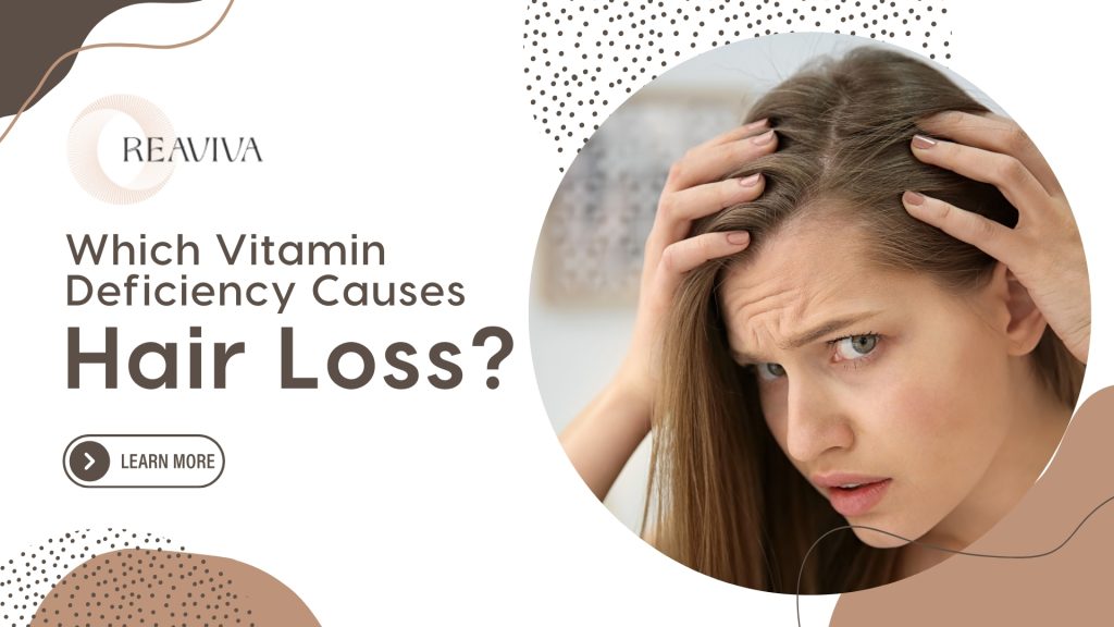 Informative visual on vitamin deficiencies causing hair loss, featuring a concerned woman examining her thinning hair and scalp. The text highlights the question 'Which Vitamin Deficiency Causes Hair Loss?' with a modern design and branding from 'Reaviva.' Common vitamin deficiencies linked to hair loss include Biotin (Vitamin B7), Vitamin D, Iron, and Zinc. The image encourages users to learn more about the role of essential nutrients in hair health and how deficiency can lead to shedding and weak hair growth.